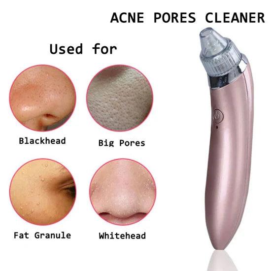 Blackhead Remover Facial Cleaner